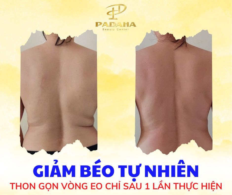 Có Nên Massage Giảm Béo Tại Padaha? Chất Lượng, Báo Giá Chi Tiết? 15